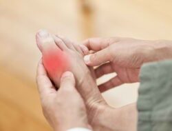 Anda Penderita Asam Urat dan Nyeri Sendi ? Ini 6 Obat Rekomendasi di Apotek