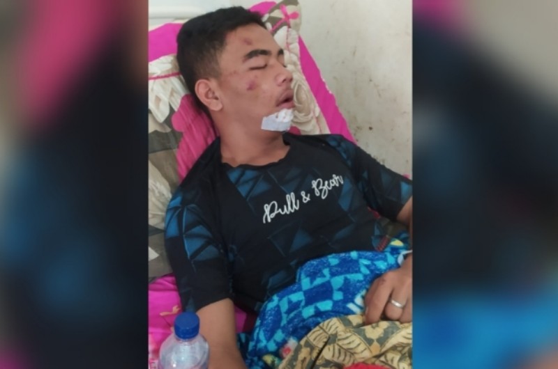 korban kecelakaan hariandaerah.com3